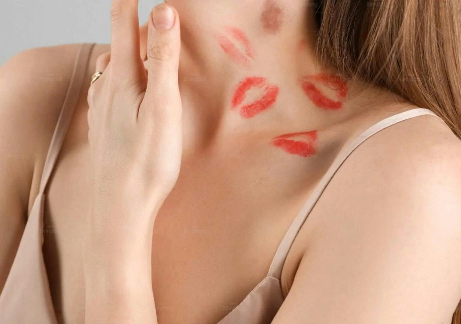 Cách xóa vết hickey nhanh nhất: Làm mờ vết bầm an toàn tại nhà