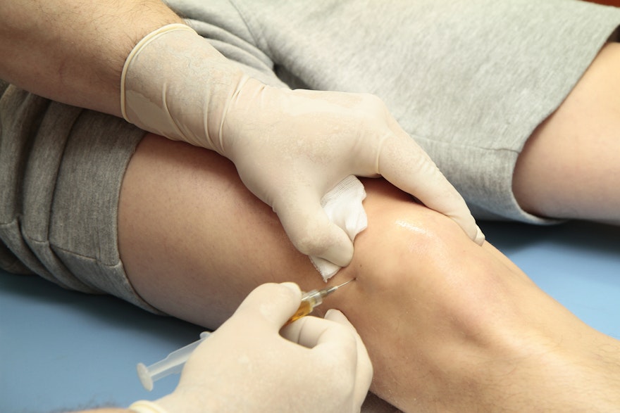 Stem Cells: How They Can Treat Injuries and Diseases