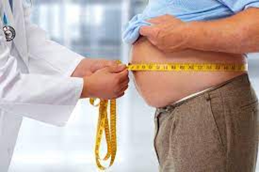 What is Obesity and Why Does it Matter?